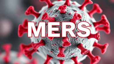 MERS вирус — причины и уроки
