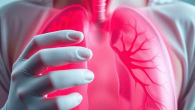 SARS 2003 — атипичная пневмония